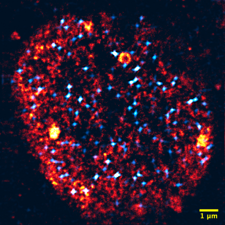 Microscopy of a nucleus: Transcription factories are colored orange, activated genes light blue. The nucleus has about one tenth of the thickness of a human hair. 