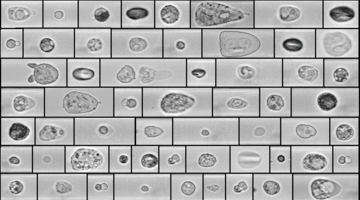[Translate to DE:] Representative microscopic images of different cells obtained with RAPID